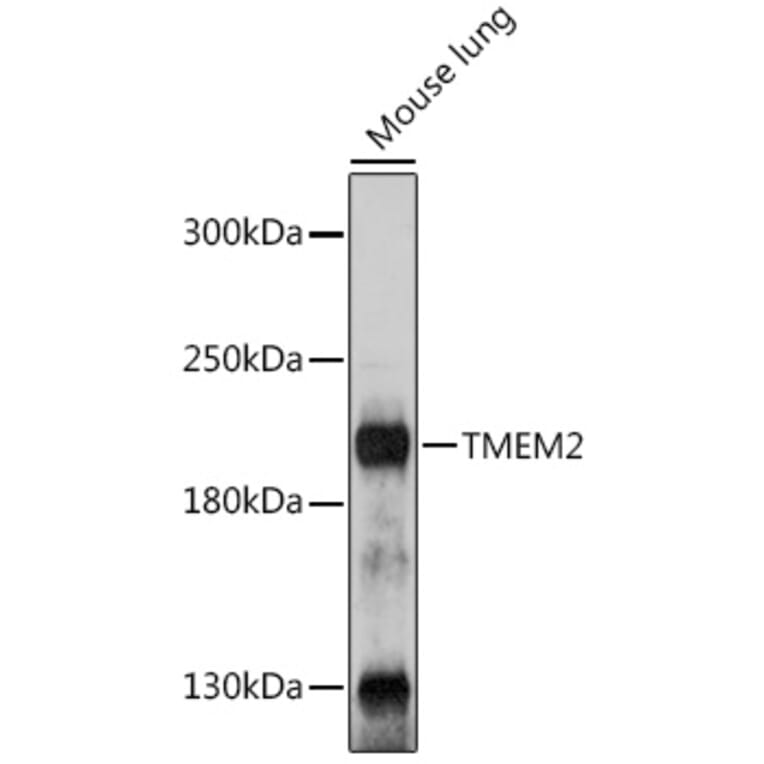 Western Blot - Anti-TMEM2 Antibody (A305792) - Antibodies.com