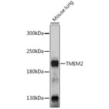Western Blot - Anti-TMEM2 Antibody (A305792) - Antibodies.com