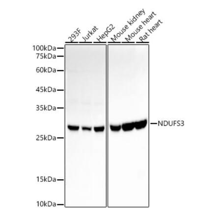 Western Blot - Anti-NDUFS3 Antibody [ARC55923] (A305794) - Antibodies.com