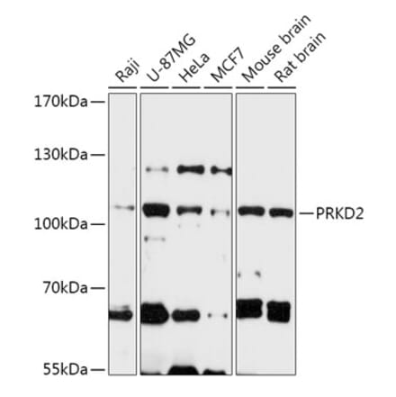 Western Blot - Anti-PKD2 Antibody (A305795) - Antibodies.com