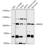 Western Blot - Anti-PKD2 Antibody (A305795) - Antibodies.com