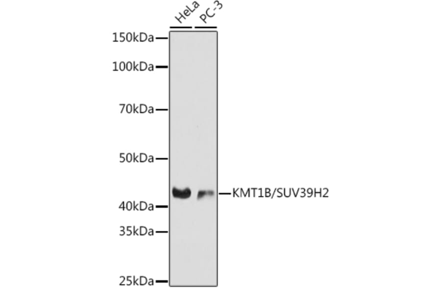 Western Blot - Anti-KMT1B/SUV39H2 Antibody [ARC0829] (A305796) - Antibodies.com