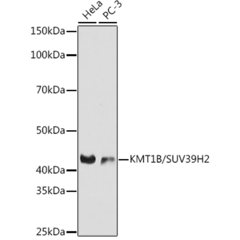 Western Blot - Anti-KMT1B/SUV39H2 Antibody [ARC0829] (A305796) - Antibodies.com