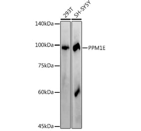 Western Blot - Anti-PPM1E Antibody (A305797) - Antibodies.com
