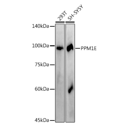 Western Blot - Anti-PPM1E Antibody [ARC2763] (A305797) - Antibodies.com
