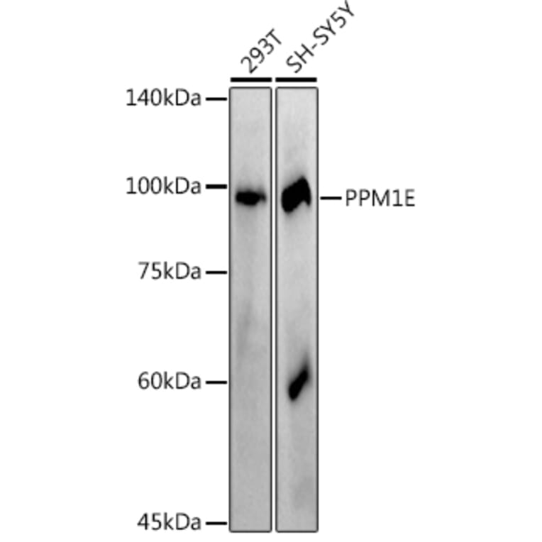 Western Blot - Anti-PPM1E Antibody [ARC2763] (A305797) - Antibodies.com