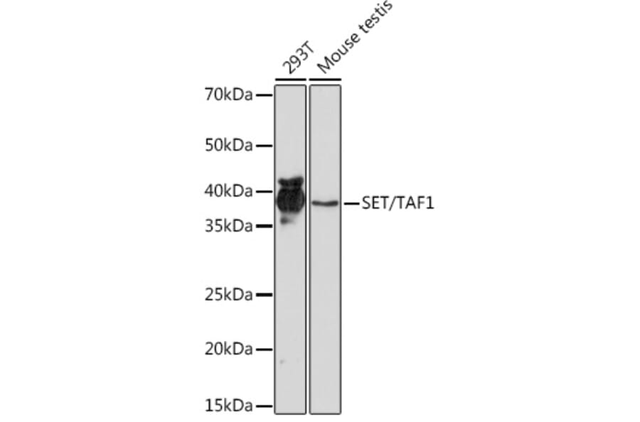 Western Blot - Anti-SET/TAF-I Antibody [ARC1462] (A305799) - Antibodies.com