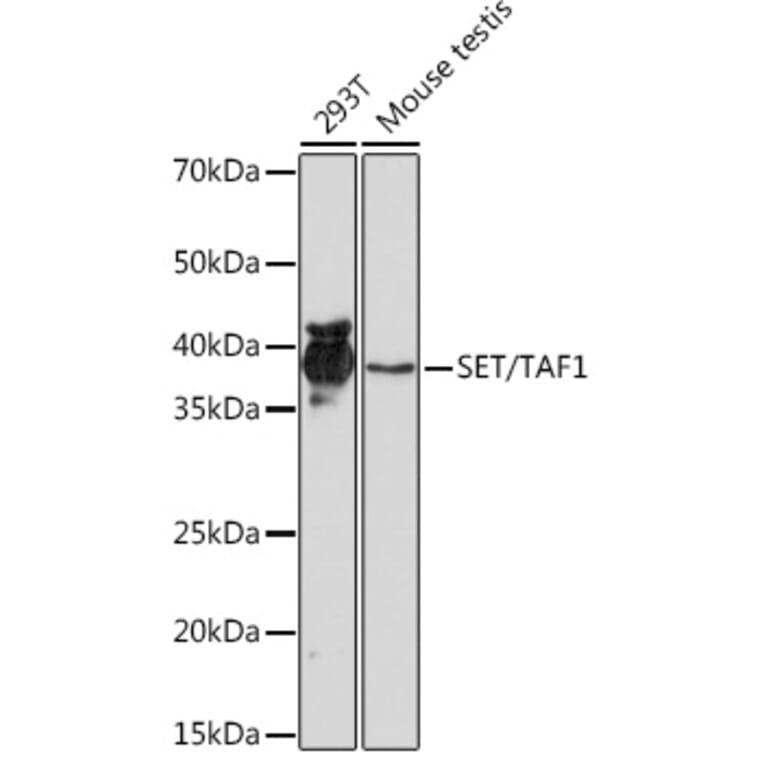 Western Blot - Anti-SET/TAF-I Antibody [ARC1462] (A305799) - Antibodies.com