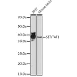 Western Blot - Anti-SET/TAF-I Antibody [ARC1462] (A305799) - Antibodies.com
