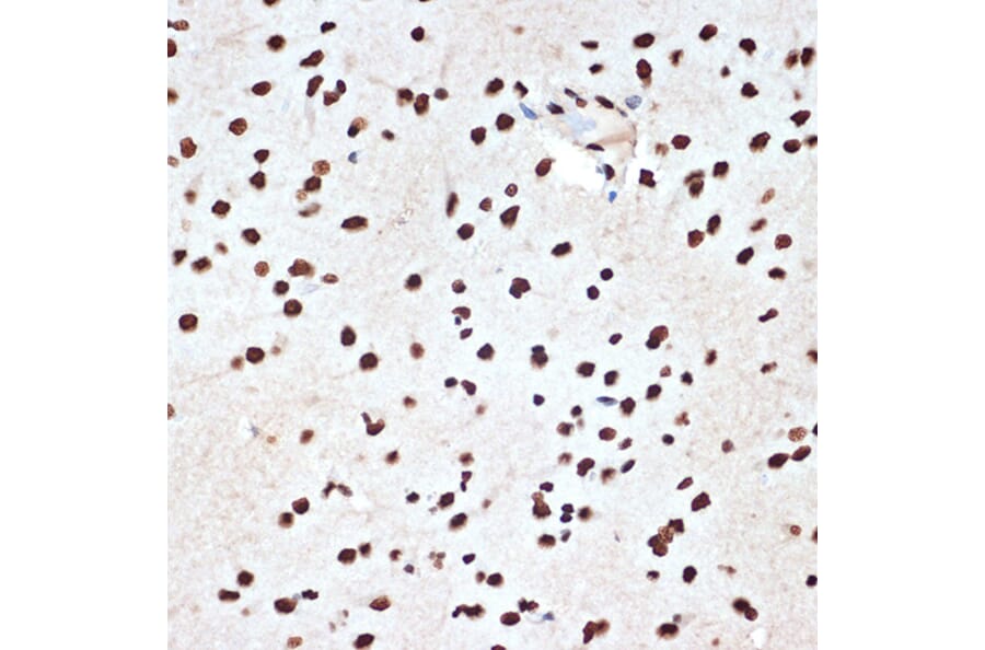 Immunohistochemistry - Anti-SET/TAF-I Antibody [ARC1462] (A305799) - Antibodies.com