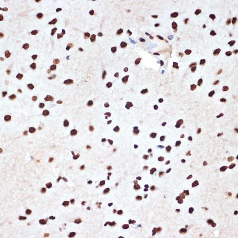 Immunohistochemistry - Anti-SET/TAF-I Antibody [ARC1462] (A305799) - Antibodies.com