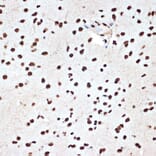 Immunohistochemistry - Anti-SET/TAF-I Antibody [ARC1462] (A305799) - Antibodies.com