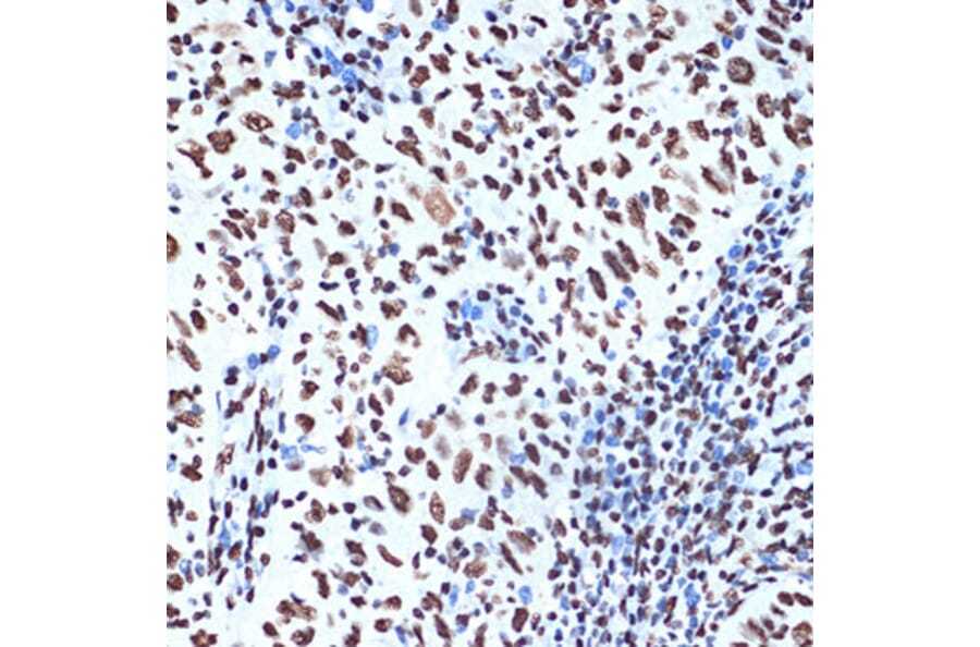 Immunohistochemistry - Anti-SET/TAF-I Antibody [ARC1462] (A305799) - Antibodies.com