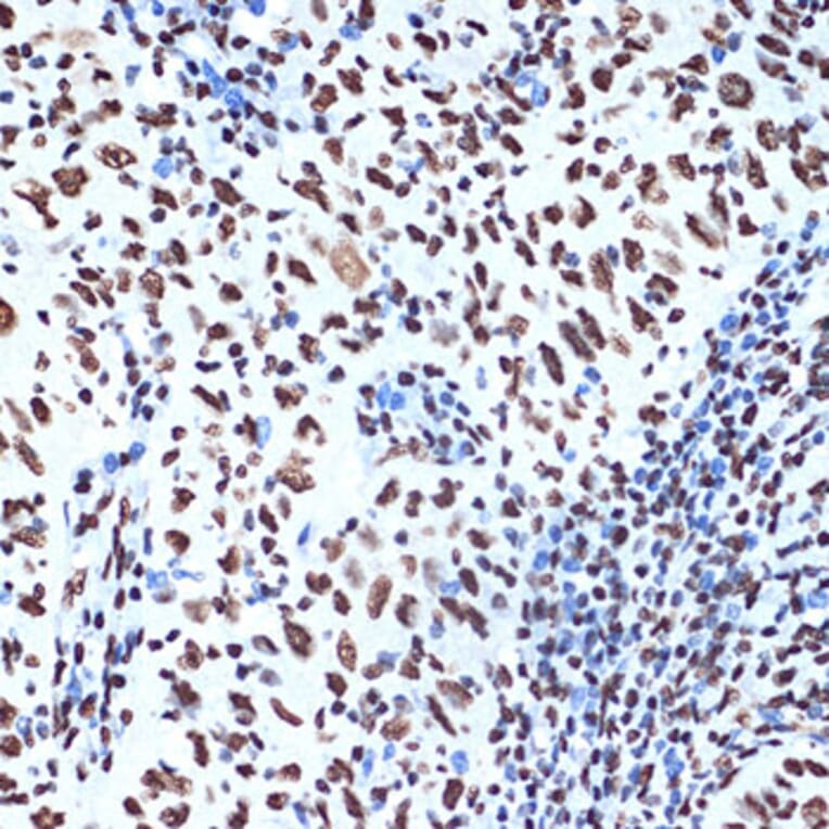 Immunohistochemistry - Anti-SET/TAF-I Antibody [ARC1462] (A305799) - Antibodies.com