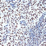 Immunohistochemistry - Anti-SET/TAF-I Antibody [ARC1462] (A305799) - Antibodies.com