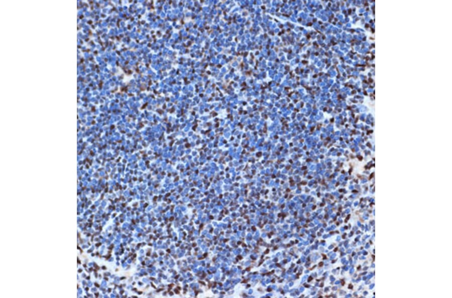 Immunohistochemistry - Anti-SET/TAF-I Antibody [ARC1462] (A305799) - Antibodies.com