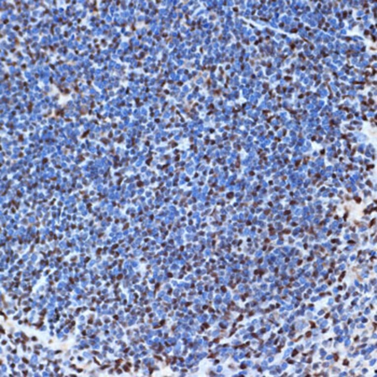 Immunohistochemistry - Anti-SET/TAF-I Antibody [ARC1462] (A305799) - Antibodies.com