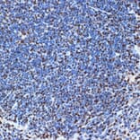 Immunohistochemistry - Anti-SET/TAF-I Antibody [ARC1462] (A305799) - Antibodies.com