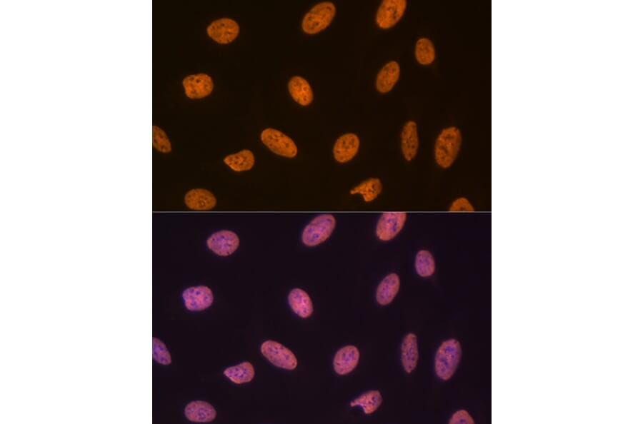 Immunofluorescence - Anti-SET/TAF-I Antibody [ARC1462] (A305799) - Antibodies.com