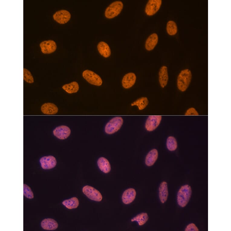 Immunofluorescence - Anti-SET/TAF-I Antibody [ARC1462] (A305799) - Antibodies.com