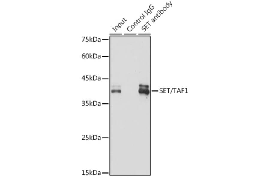 Western Blot - Anti-SET/TAF-I Antibody [ARC1462] (A305799) - Antibodies.com