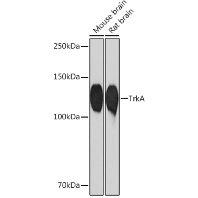 Western Blot - Anti-TrkA Antibody [ARC0906] (A305801) - Antibodies.com
