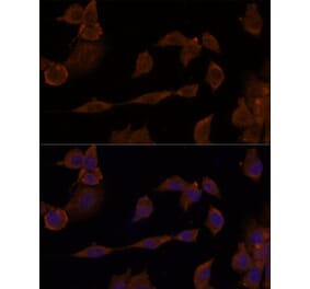 Immunofluorescence - Anti-GNA11 Antibody (A305802) - Antibodies.com