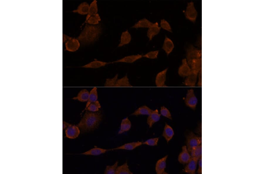 Immunofluorescence - Anti-GNA11 Antibody (A305802) - Antibodies.com