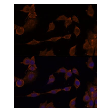 Immunofluorescence - Anti-GNA11 Antibody (A305802) - Antibodies.com
