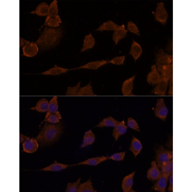 Immunofluorescence - Anti-GNA11 Antibody (A305802) - Antibodies.com