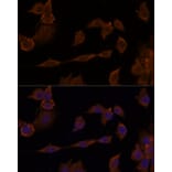 Immunofluorescence - Anti-GNA11 Antibody (A305802) - Antibodies.com