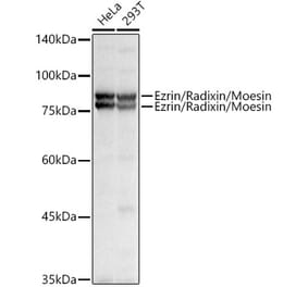 Western Blot - Anti-Ezrin Antibody (A305803) - Antibodies.com