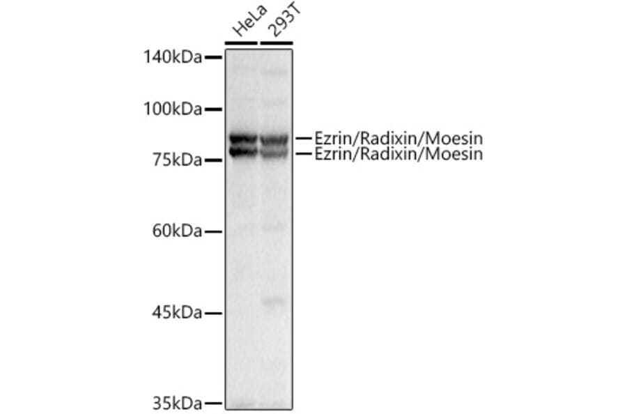 Western Blot - Anti-Ezrin Antibody (A305803) - Antibodies.com
