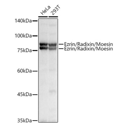 Western Blot - Anti-Ezrin Antibody (A305803) - Antibodies.com
