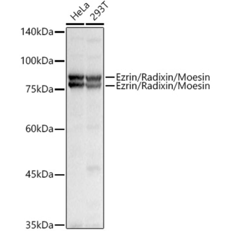 Western Blot - Anti-Ezrin Antibody (A305803) - Antibodies.com