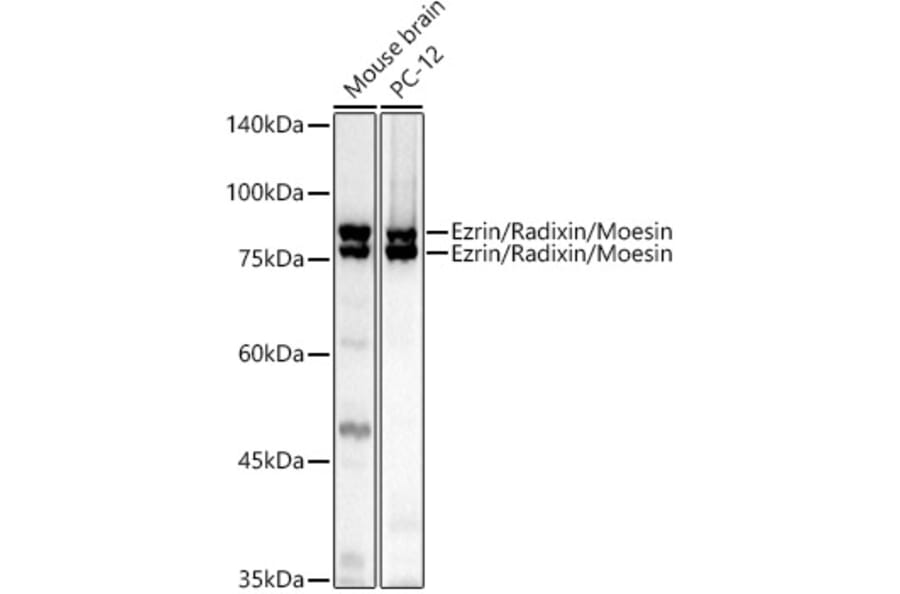 Western Blot - Anti-Ezrin Antibody (A305803) - Antibodies.com