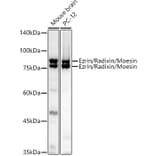 Western Blot - Anti-Ezrin Antibody (A305803) - Antibodies.com