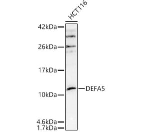 Western Blot - Anti-alpha Defensin 5 Antibody (A305804) - Antibodies.com
