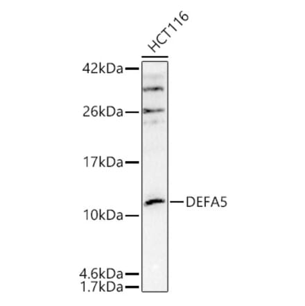 Western Blot - Anti-alpha Defensin 5 Antibody (A305804) - Antibodies.com