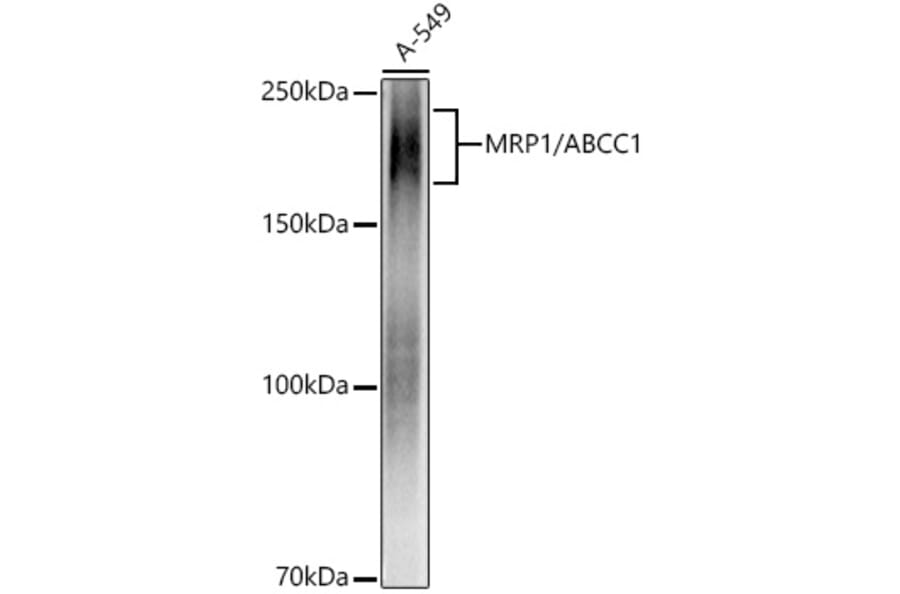 Western Blot - Anti-MRP1 Antibody [ARC52207] (A305805) - Antibodies.com