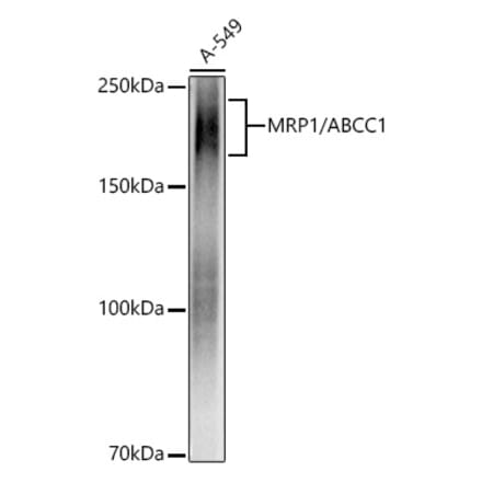 Western Blot - Anti-MRP1 Antibody [ARC52207] (A305805) - Antibodies.com