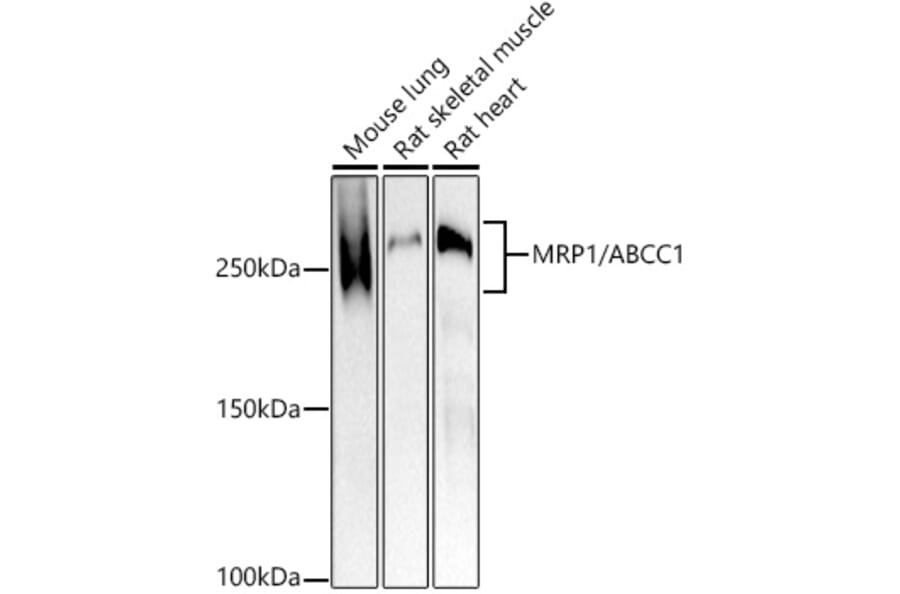 Western Blot - Anti-MRP1 Antibody [ARC52207] (A305805) - Antibodies.com