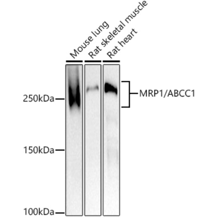 Western Blot - Anti-MRP1 Antibody [ARC52207] (A305805) - Antibodies.com