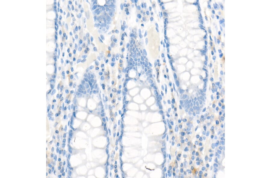 Immunohistochemistry - Anti-MRP1 Antibody [ARC52207] (A305805) - Antibodies.com
