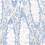 Immunohistochemistry - Anti-MRP1 Antibody [ARC52207] (A305805) - Antibodies.com