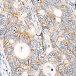 Immunohistochemistry - Anti-MRP1 Antibody [ARC52207] (A305805) - Antibodies.com