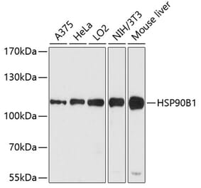 Western Blot - Anti-GRP94 Antibody (A305806) - Antibodies.com