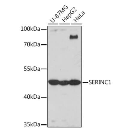 Western Blot - Anti-SERINC1 Antibody (A305807) - Antibodies.com