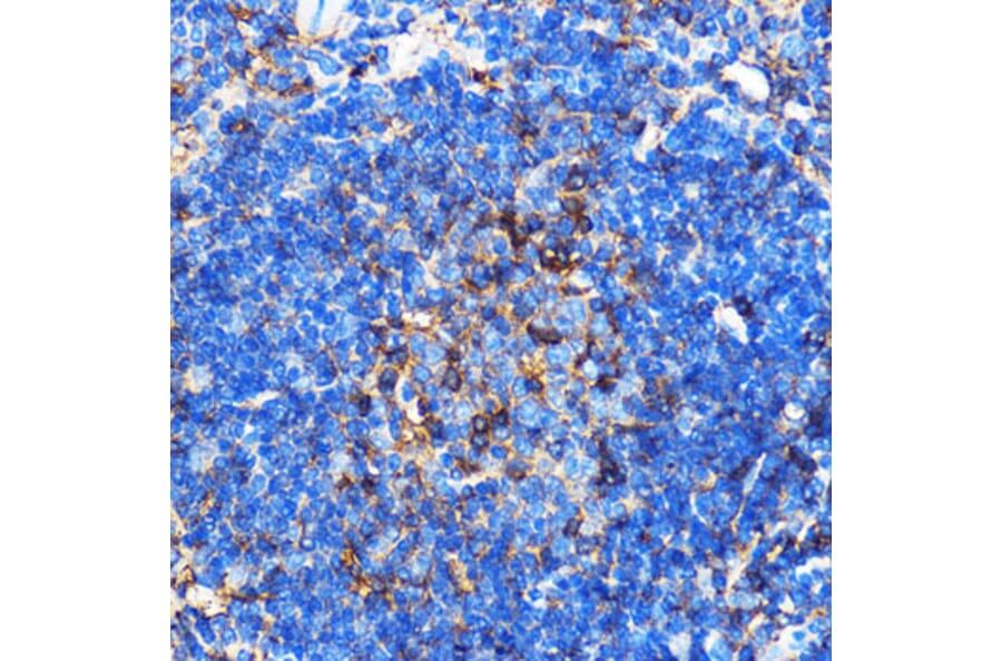 Immunohistochemistry - Anti-SERINC1 Antibody (A305807) - Antibodies.com