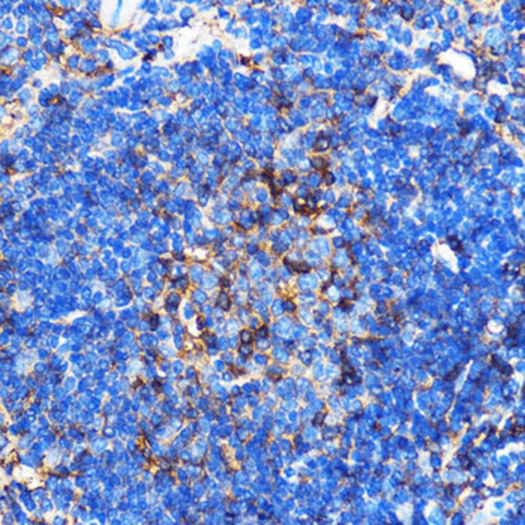 Immunohistochemistry - Anti-SERINC1 Antibody (A305807) - Antibodies.com